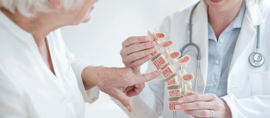 Osteoporosis - Endocrinología clínica